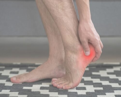 Fascitis Plantar