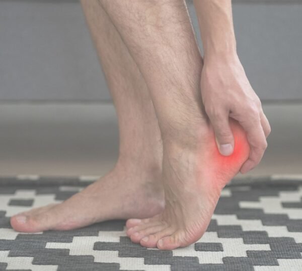 Fascitis Plantar